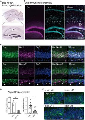 Role of desmoplakin in supporting neuronal activity, neurogenic processes, and emotional-related behaviors in the dentate gyrus